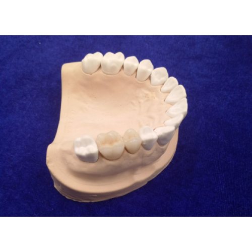 Cobalt Chromium Alloy ceramic teeth